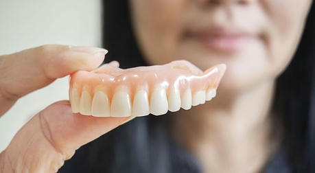 Dental Implants on a Budget: How to Achieve a Beautiful Smile Without Breaking the Bank